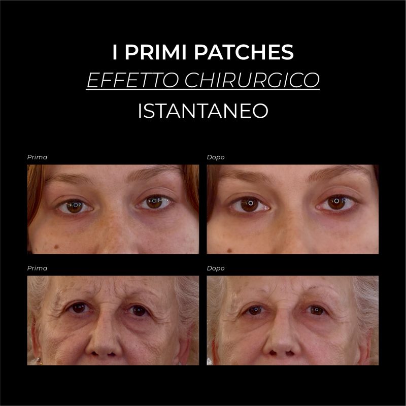 OVER SIZE EYE & CHEEK PATCHES